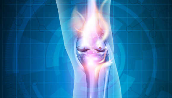 Image for Automate Bill-Only Implant Orders: Real-World Success Stories 